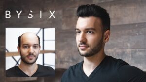 BYSIX (Compléments capillaires)